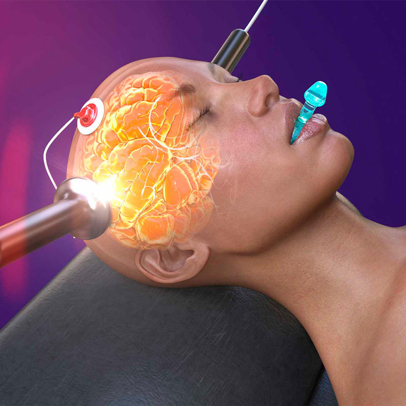 ECT Treatment
